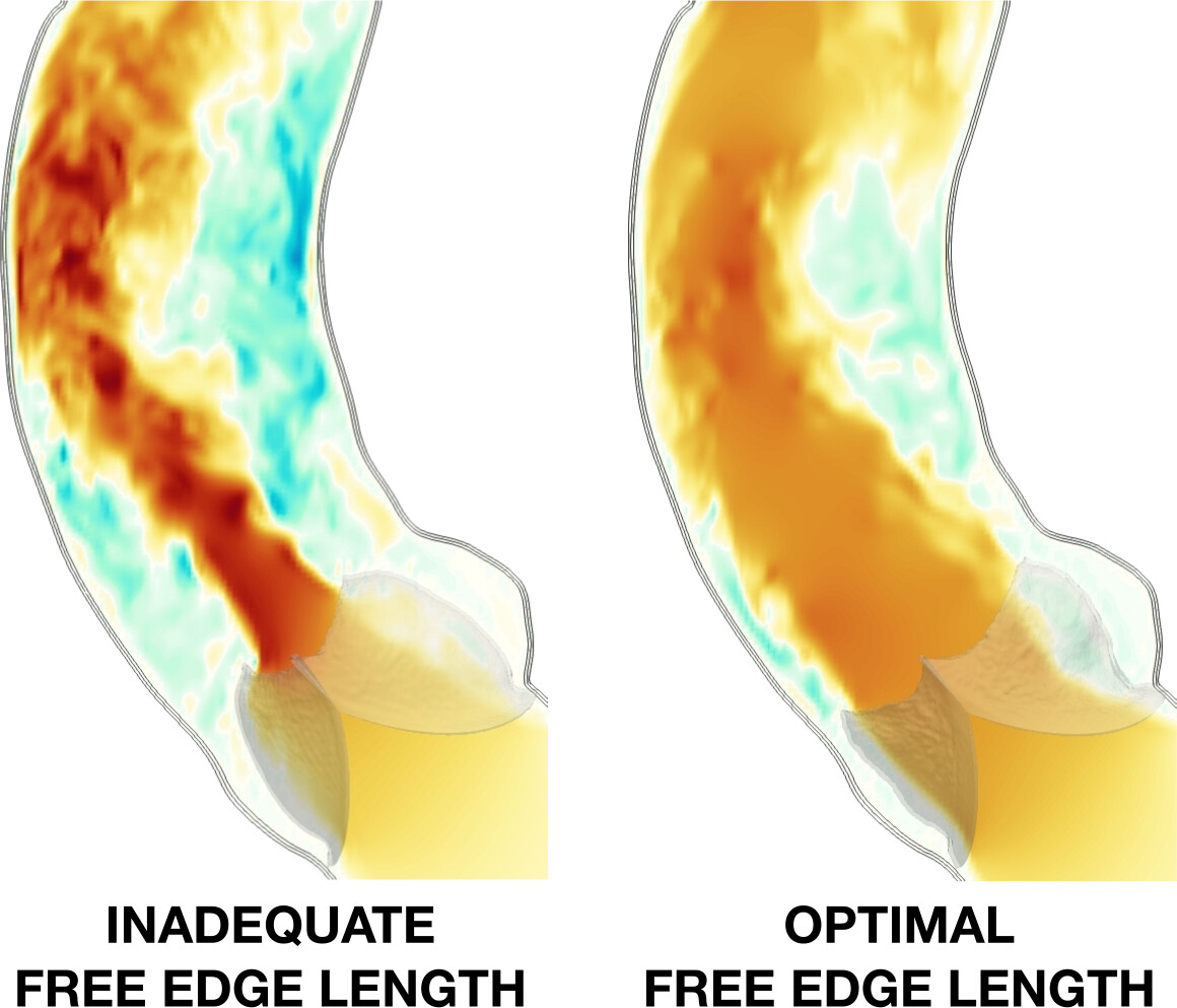 Simulated bicuspid aortic valve